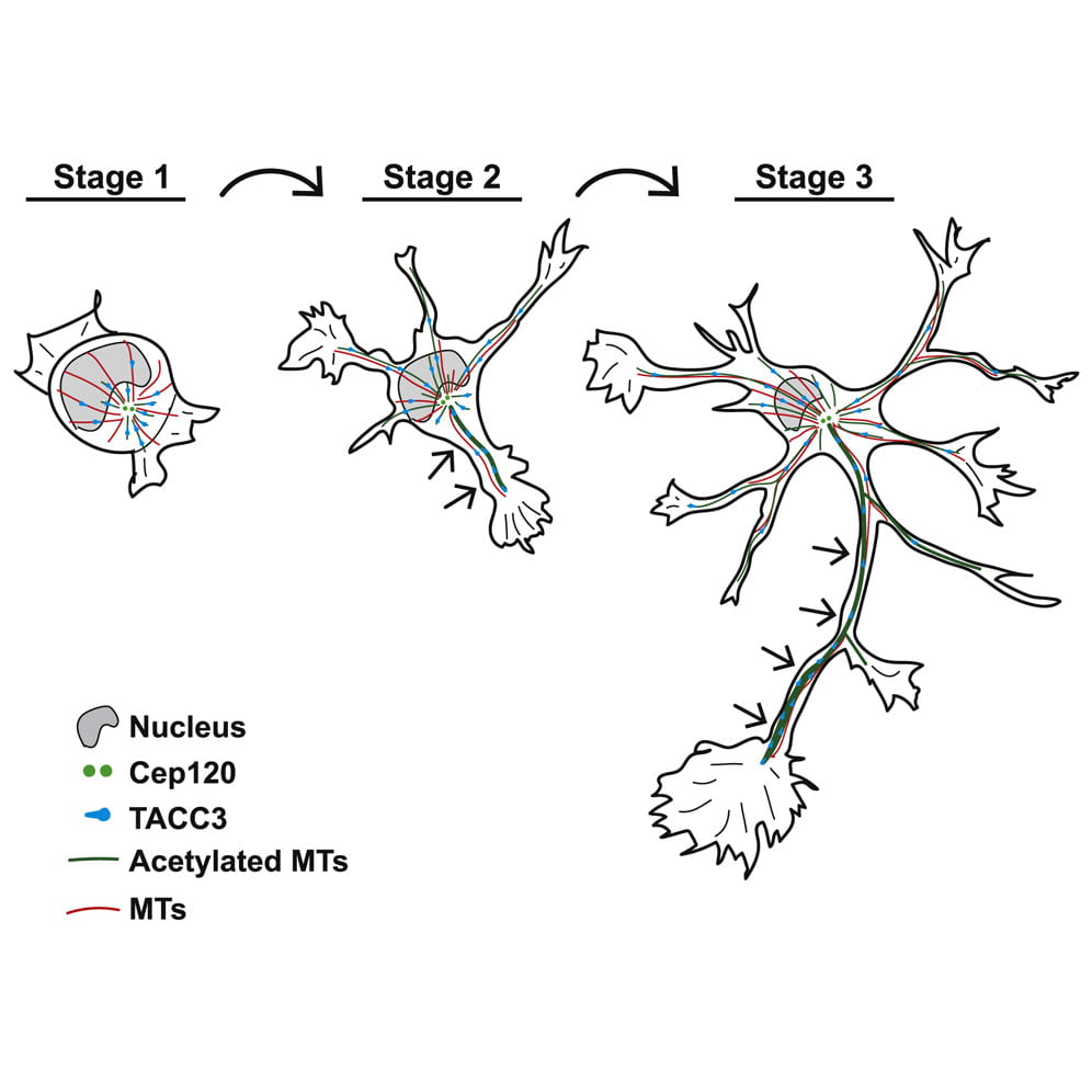 Our collaboration on the role of Cep120 in  axon development is published in Cell Reports