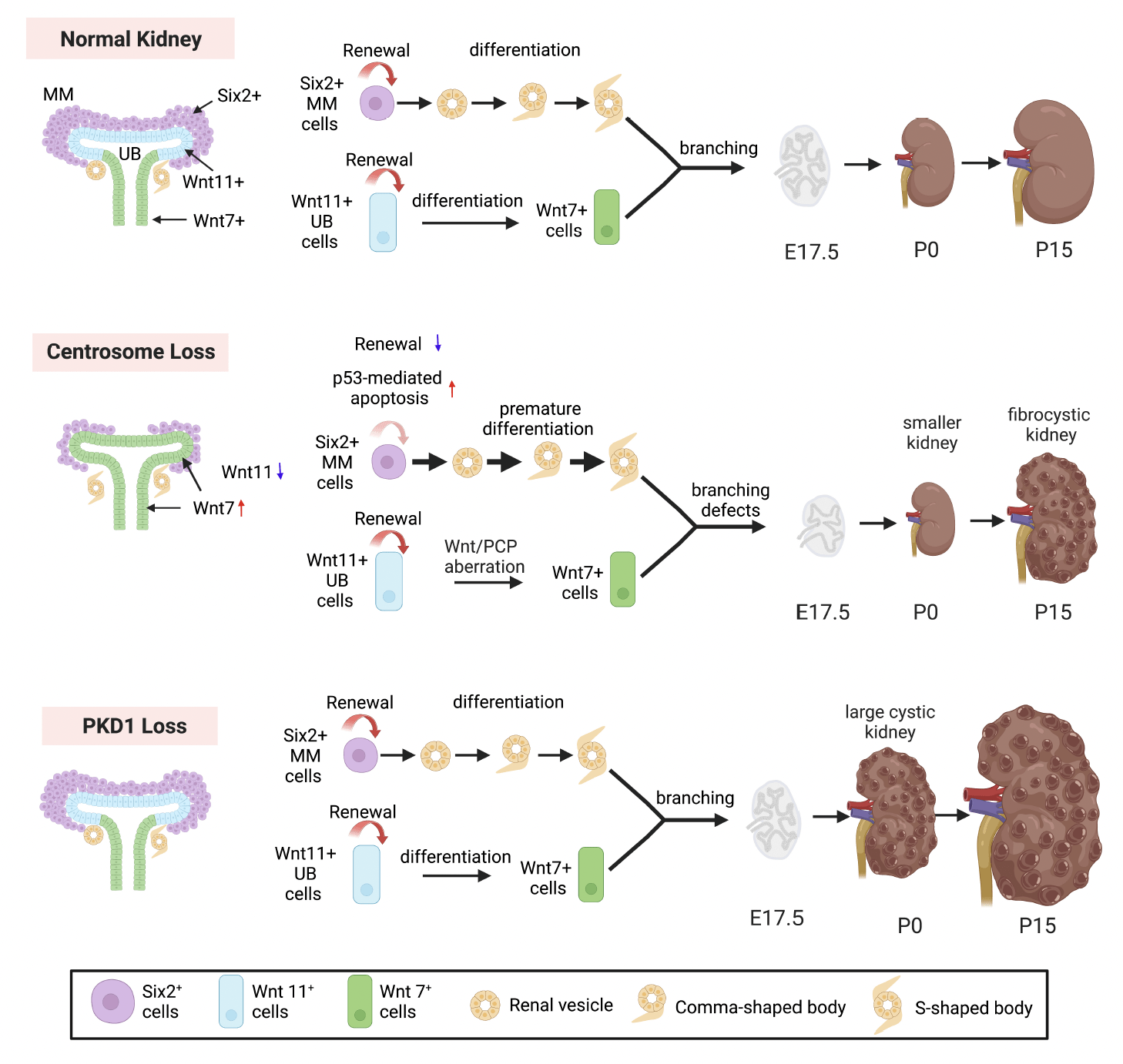 Tao’s new preprint on the consequences of Cep120/centrosome loss in nephron progenitors during kidney development is now on bioRxiv